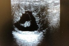 mc-repro-ultrasonography-pic